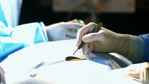 Close-up of surgeons performing operation in operation room