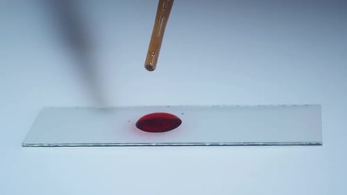 Lab Technician Holding Pipette and Testing Blood Samples on Hospital Ward for Blood Transfusion