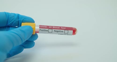 COVID-19 Blood Test Positive Result Marked by Hand