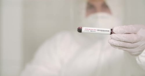 Medical Professional Holding Negative Covid Blood Test
