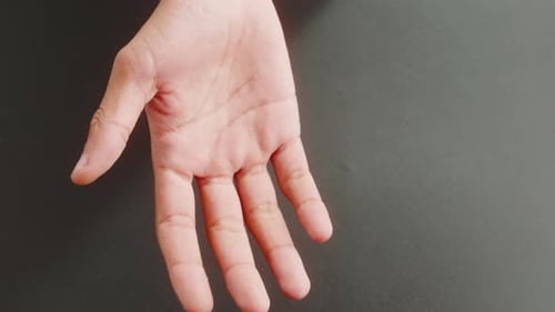 Hand Opening and Closing into a Fist