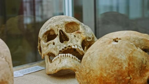 Menschlicher Schädel in einer Vitrine