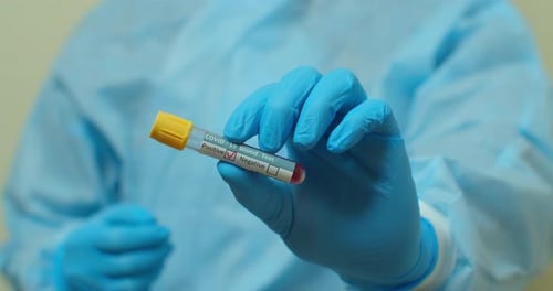 Positive COVID-19 Blood Test in Vial