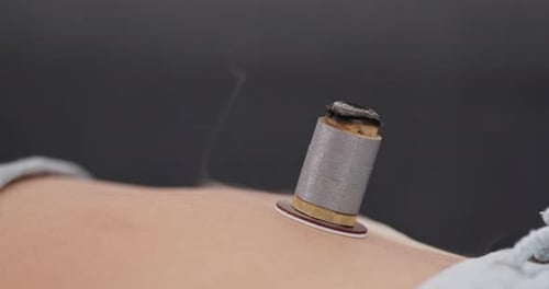 Thérapie par moxibustion en médecine chinoise