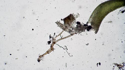 El rotífero se esconde entre las algas y allí se alimenta del microcosmos