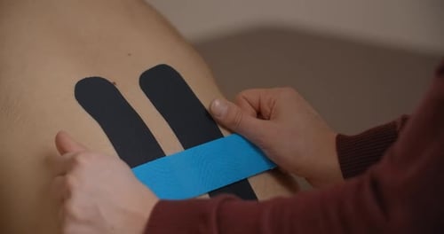 Blue Tape Applied to Patient's Back for Therapy