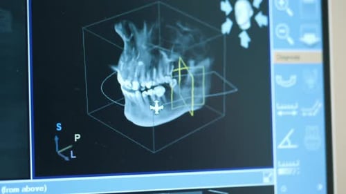 Closeup of Doctor Dentist Looks at Looks 3d Model of Xrays of the Patient's Jaw and Teeth on the