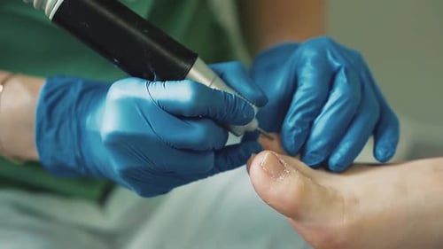Podiatrist Performing a Pedicure Treatment on a Foot