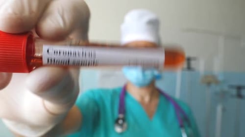 Doctor Holding Coronavirus Blood Sample in Test Tube