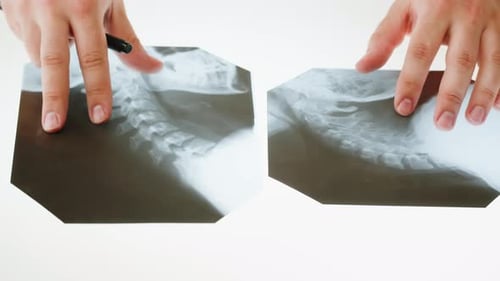 Doctor Reviews X-Ray of Human Spine on White Table