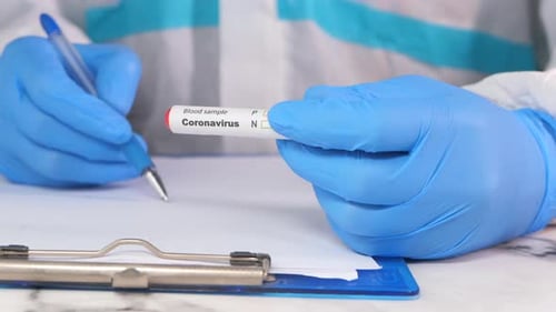 Labortechniker hält Blutresten in der Hand und schreibt auf Papier