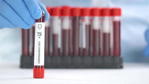 Coronavirus Blood Sample Marked Positive