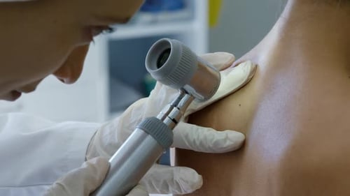 Doctor Examining Patient's Skin with Medical Instrument