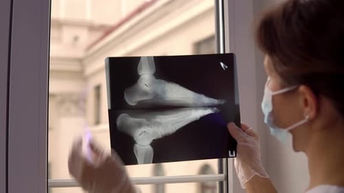 Arzt untersucht Röntgenfilm eines gebrochenen Fußes
