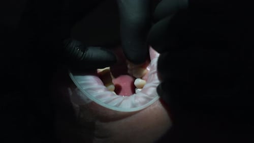 Dentist Performing Dental Procedure Close Up