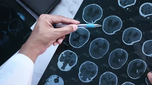 Doctor Reviewing Brain Scan Exam Results