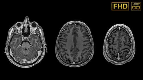 Mri Brain Overhead Slow Detailed