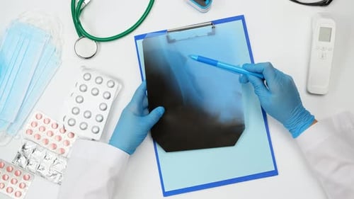 doctor in blue gloves holds an x-ray of a bone and examines it