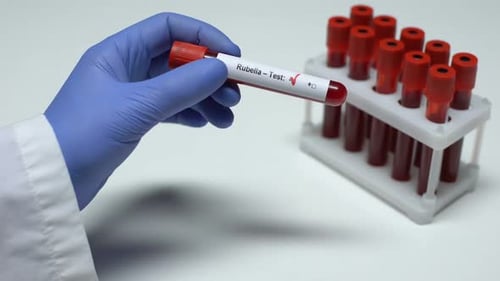 Negativer Röteln-Test, Arzt zeigt Blutprobe, Laborforschung, Gesundheitsuntersuchung