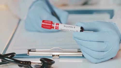 Medical Professional Records Hepatitis C Blood Test Results