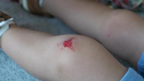 Mother Disinfects Child's Abrasion Wound with Spray and Cotton Pad Close Up