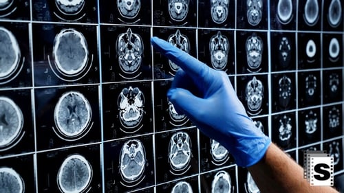 MRT-Scan-Analyse