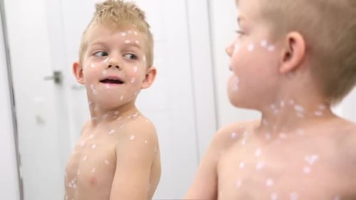 Child Covered in Spots Looks in Mirror