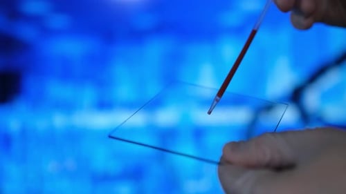 Nahaufnahme der behandschuhten Hand des Arztes Wissenschaftler mit intelligentem mobilen Bluttest, Medizinisches Labor von