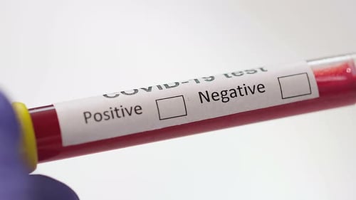 COVID-19 Blood Test Sample in Vial