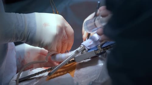 Surgeons Perform Delicate Medical Procedure in Operating Room