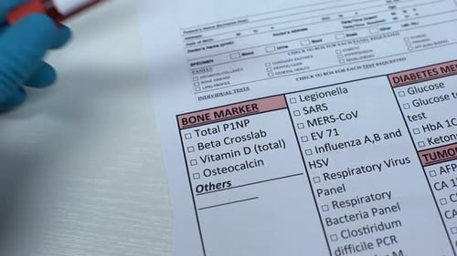 Vitamin D, Arzt überprüft Namen im Labor leer, zeigt Blutprobe im Röhrchen