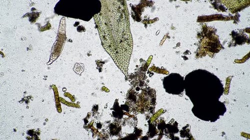 Microscopic Life Forms Swimming in Clear Fluid