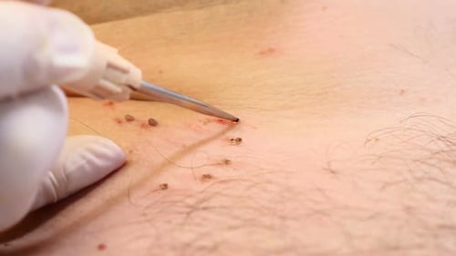 Surgery Concept