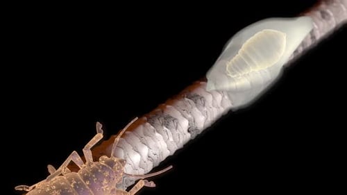 Head Louse and Nit on Human Hair Strand Animation