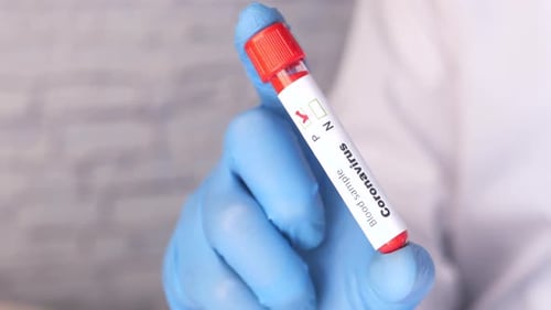 Labortechniker in medizinischen Handschuhen Hand haltendes Blutteströhrchen