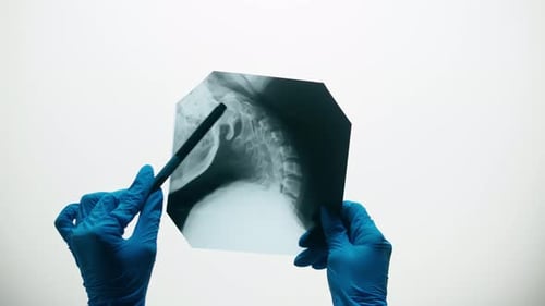 Hands in Gloves Examine an X-Ray