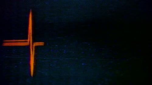 Analog abstract video shapes and noise manipulation feedback feed.