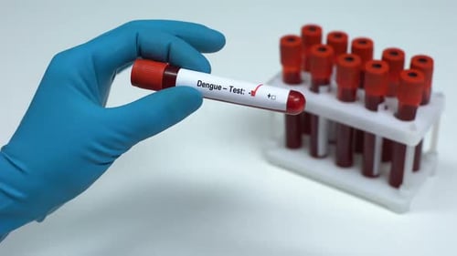 Dengue Fever Test Tube Sample Positive Result
