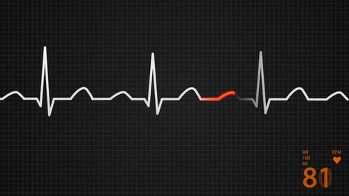 Animation of a schematic diagram of normal sinus rhythm for a human heart