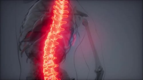 Backache in Back Bones