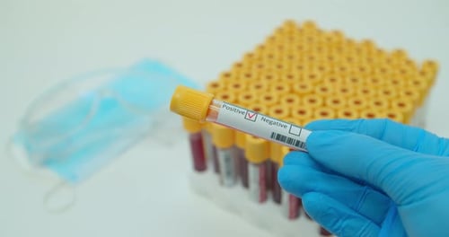 Positive Covid-19 Blood Test Close Up