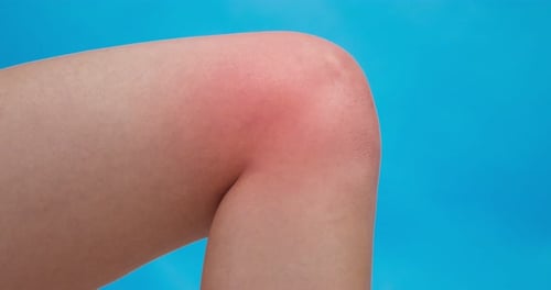 Close Up Shot of Female Knee with Red Pulsating Sore Zone Blue Studio Background