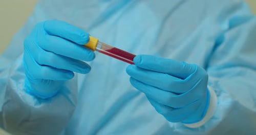 Medical Worker Holding Positive Covid-19 Blood Sample