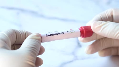 Coronavirus Test is Negative in Test Tube
