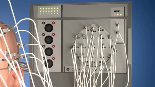 Electroencephalography machine analyzing activity of a human brain. Closeup. HD