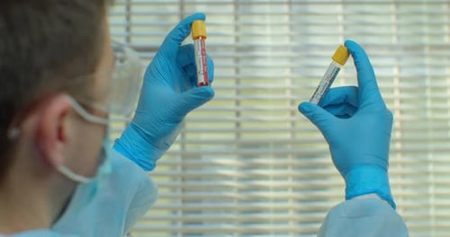 Coronavirus-Test im Labor. Covid 19. Arm in Plastikhandschuhen, der Reagenzgläser mit Testprobe hält
