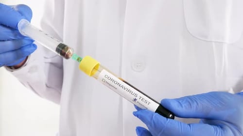Der medizinische Analyst der Spritze analysiert Blut aus einem Covid-19-positiven Reagenzglas