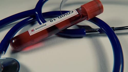 COVID-19 Positive Blood Sample and Stethoscope Close Up