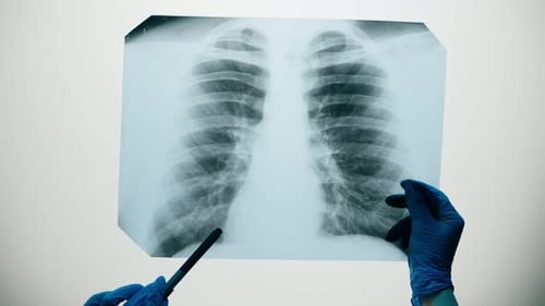 Doctor Examines Chest X-Ray