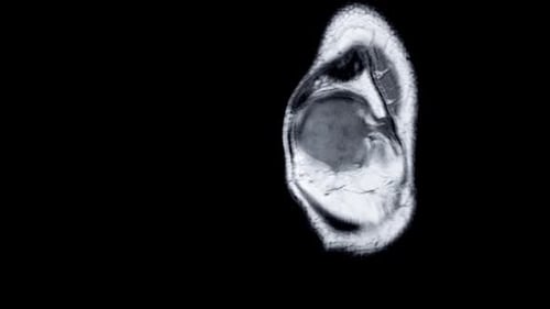 Knee Joint MRI Scan on Black Background